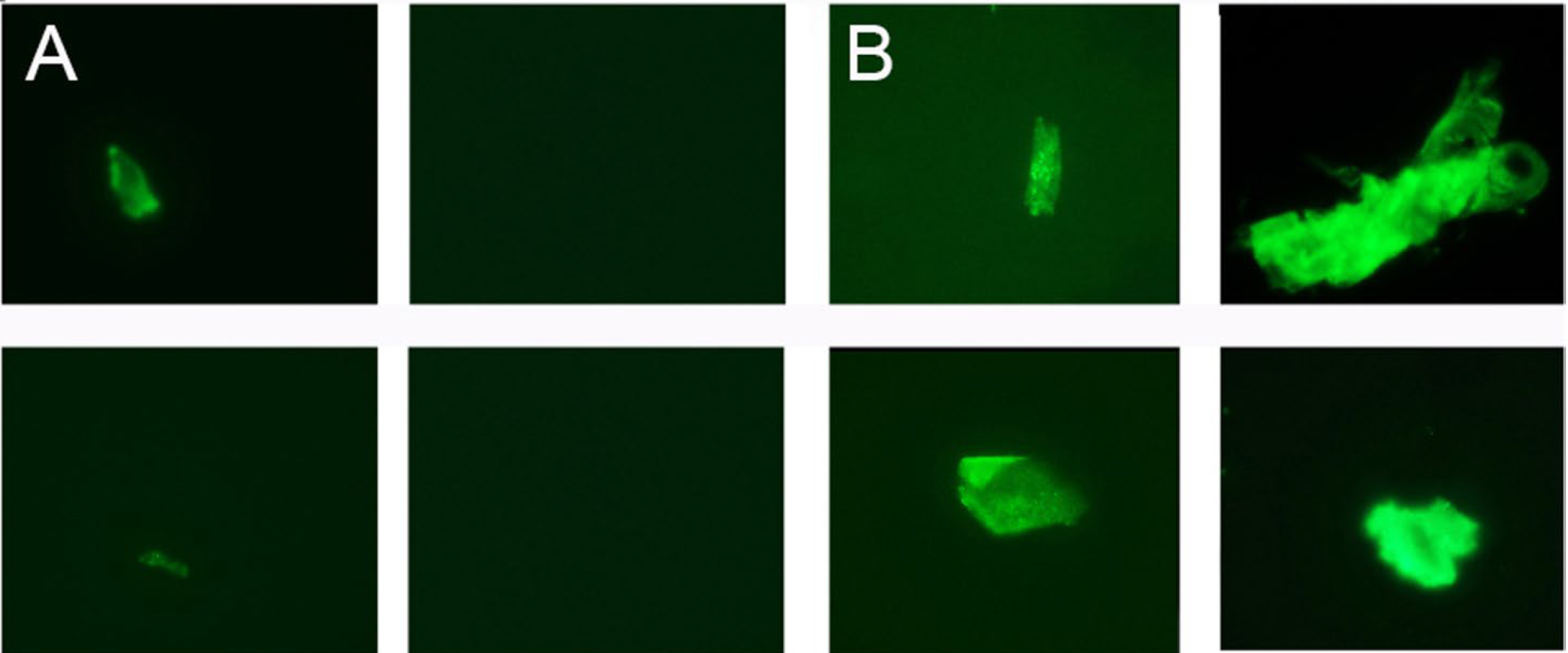 Platelet-poor plasma before and after COVID-19 infection